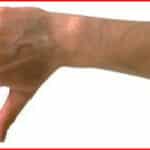 Complaints thumbs down