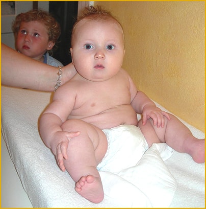 Image result for obese baby