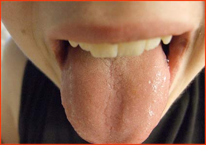 Sarah Stambaugh - boring tongue