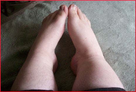 Pair of chubby feet