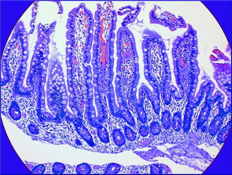 small-intestine