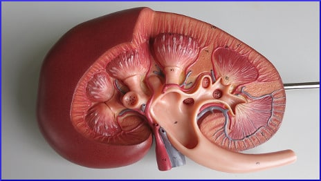 kidney-model